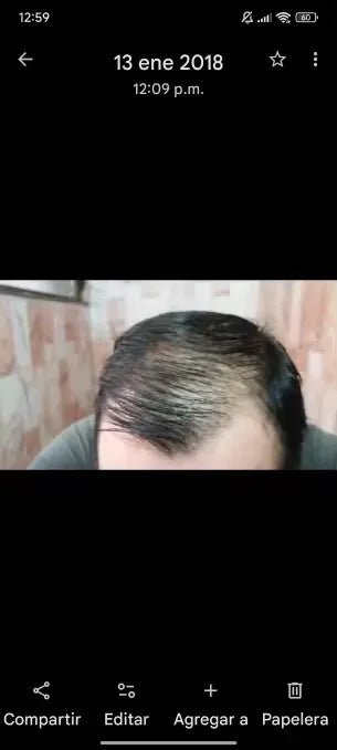 Captura de tela com vista frontal e superior do cabelo.