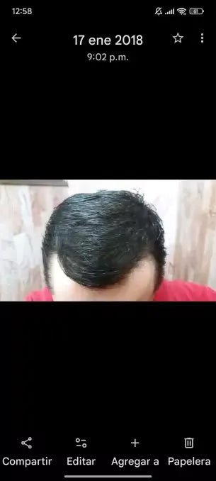 Captura de tela com vista frontal e superior do cabelo em outro momento.