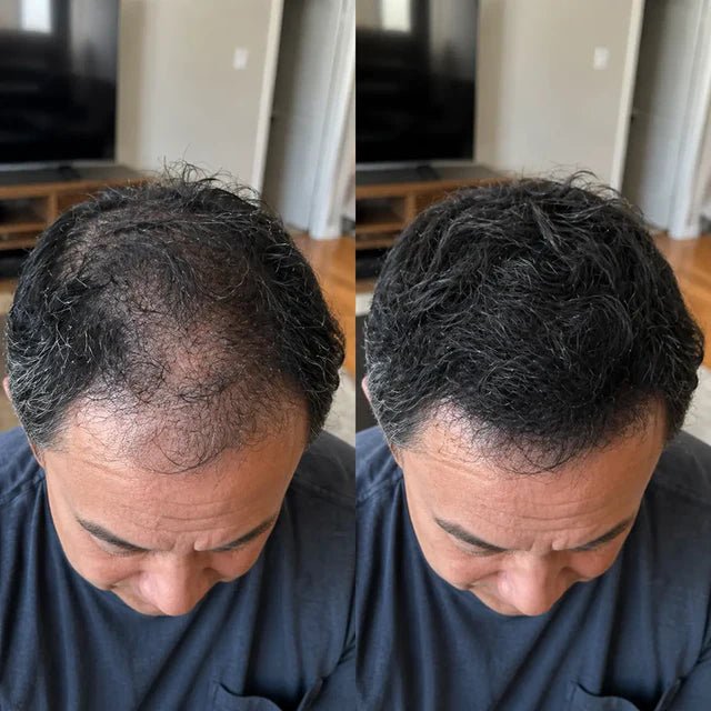 Duas vistas lado a lado mostram a região frontal e o topo do cabelo curto e escuro.