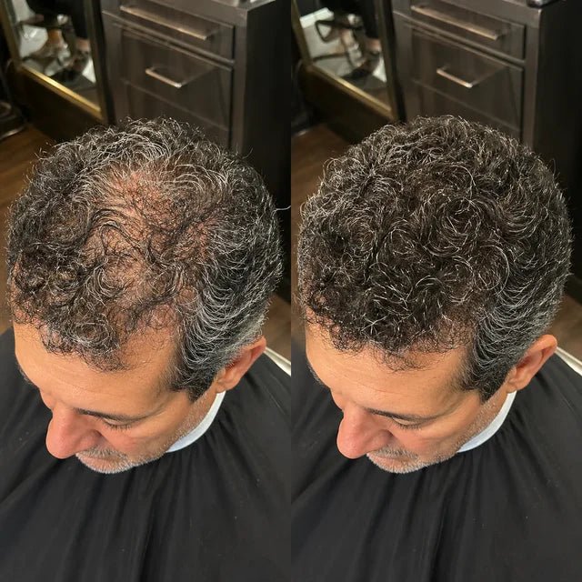 Duas vistas superiores lado a lado mostram cabelo curto e cacheado em ângulos semelhantes.