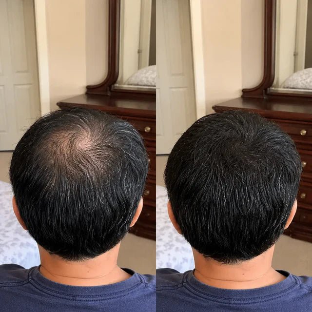 Duas vistas traseiras lado a lado mostram a coroa e o cabelo escuro em enquadramento semelhante.