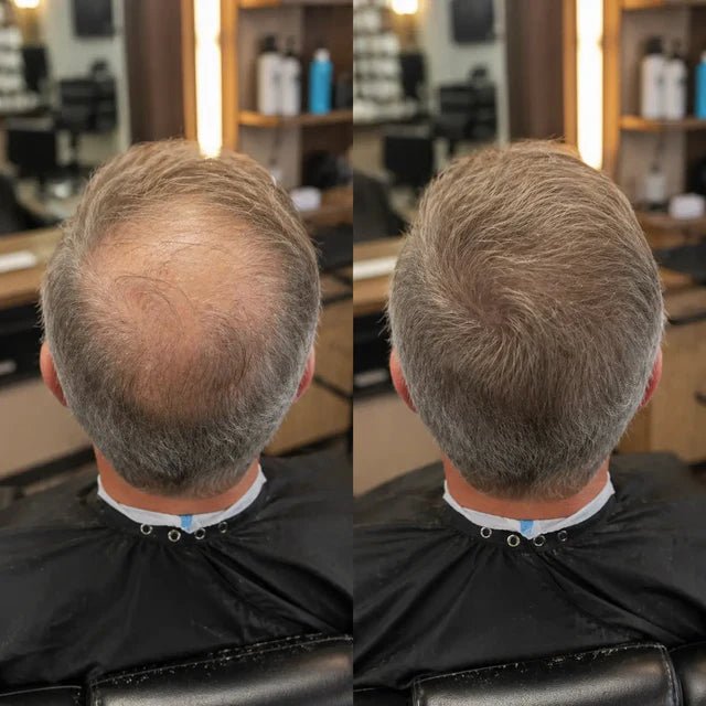 Duas vistas traseiras lado a lado mostram a coroa e o cabelo grisalho em enquadramento semelhante.